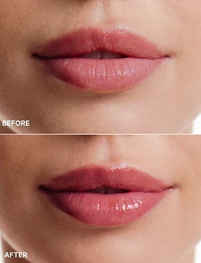 Бальзам для губ - фото 4 - Miraton