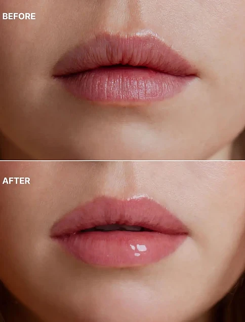 Бальзам для губ - фото 3 - Miraton